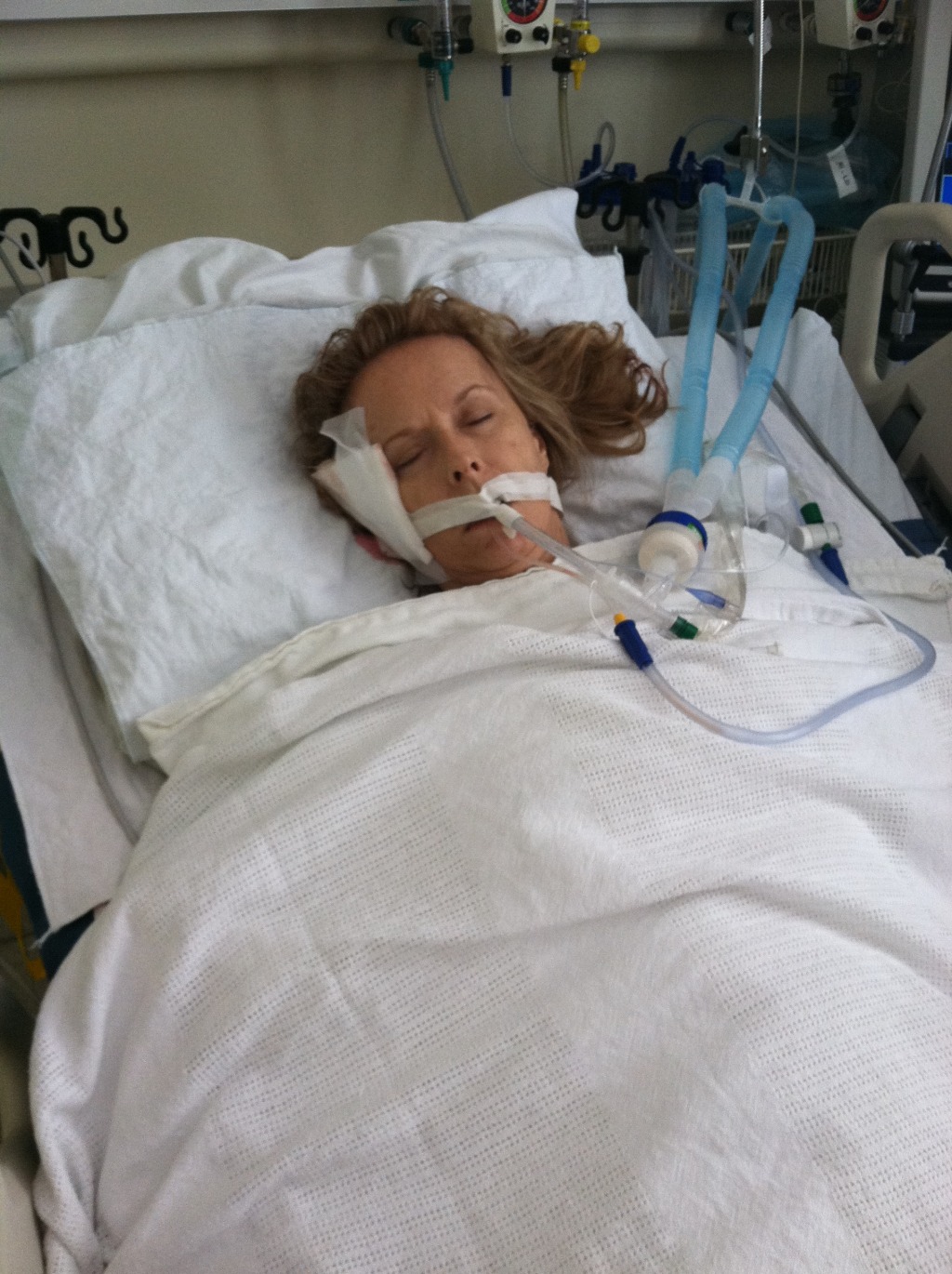 2011/05(May)/My Brain Injury Recovery/2011-05-15-Janeen's TBI-01.jpg